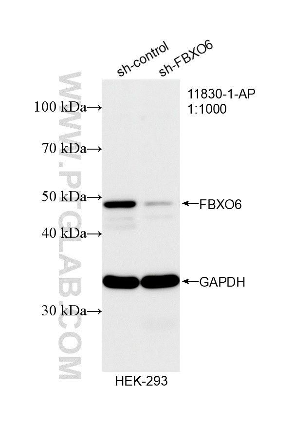 WB analysis of HEK-293 using 11830-1-AP WB analysis of HEK-293 using 11830-1-AP