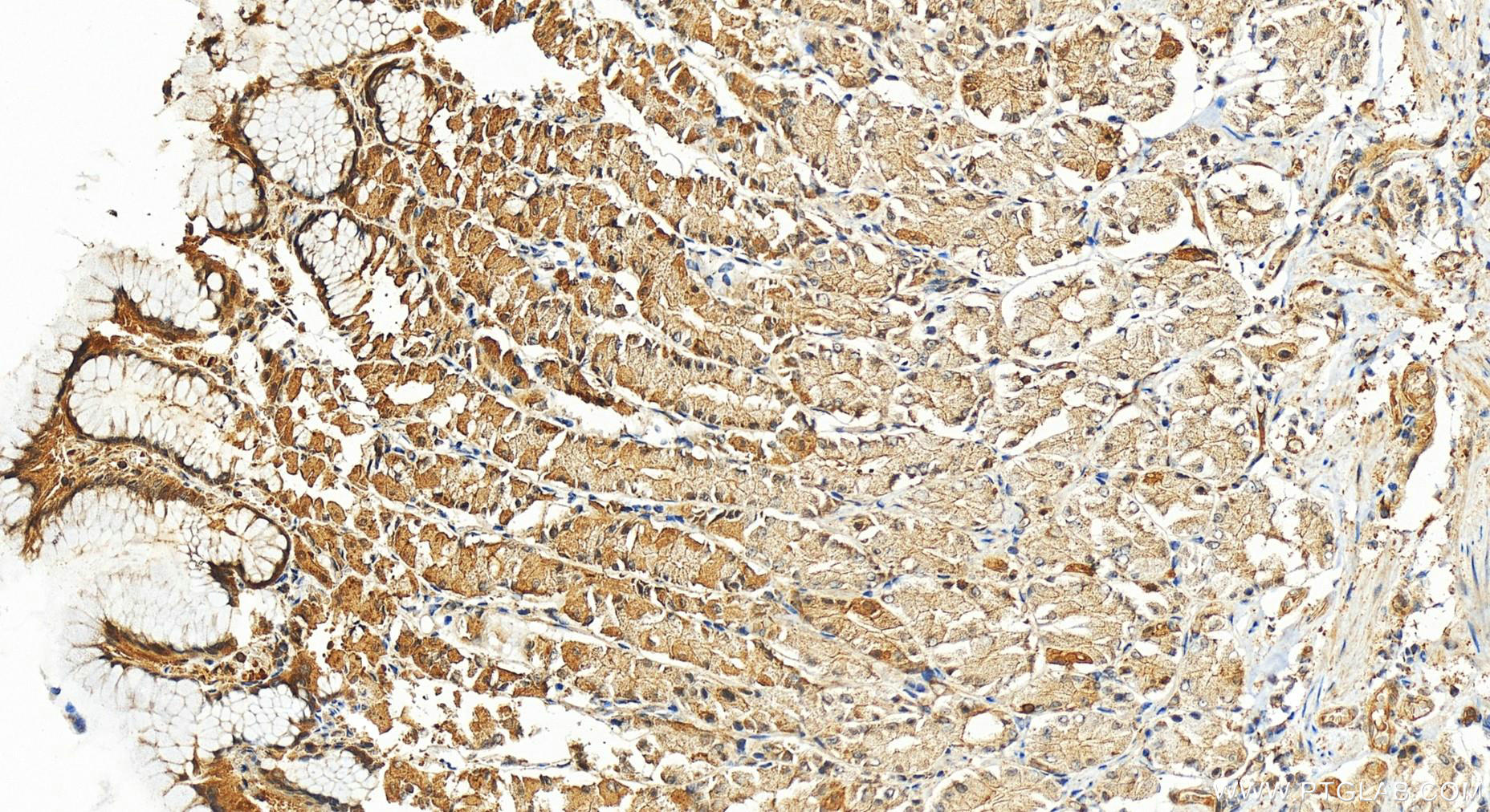 IHC staining of human stomach using 10696-1-AP