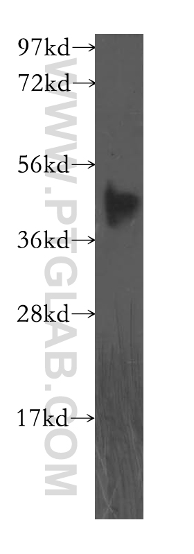 WB analysis of human placenta using 11903-1-AP