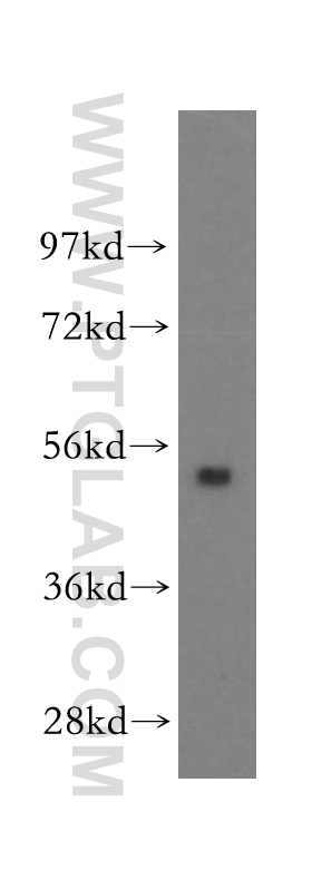 WB analysis of human liver using 11161-1-AP