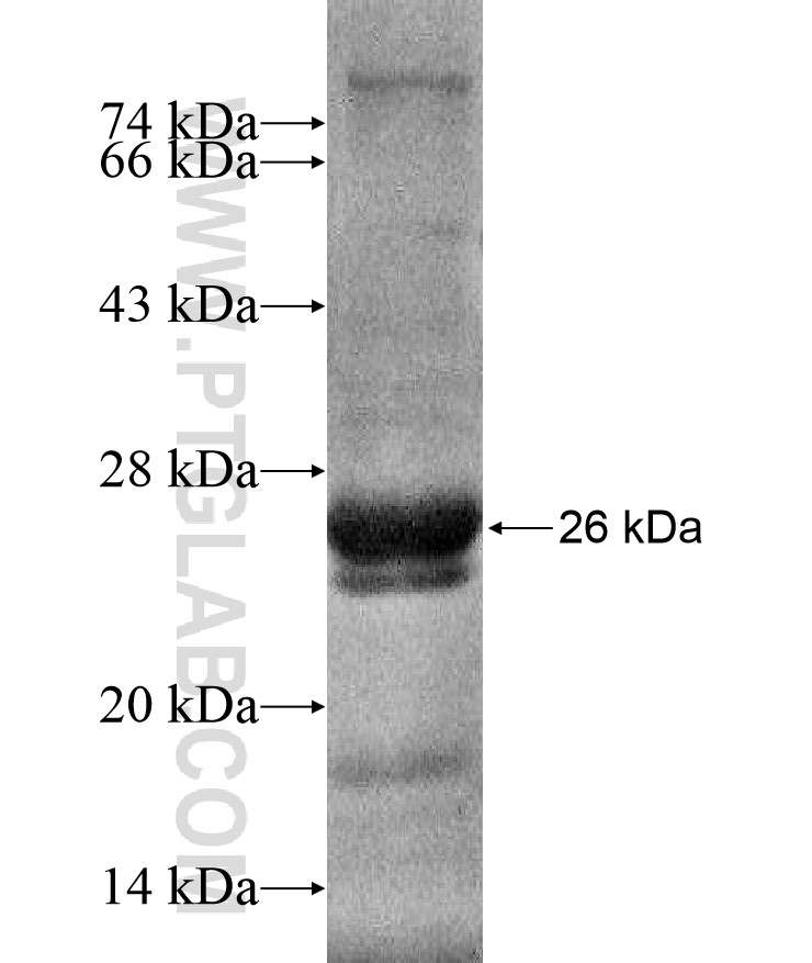 FBXW12 fusion protein Ag17057 SDS-PAGE FBXW12 fusion protein Ag17057 SDS-PAGE