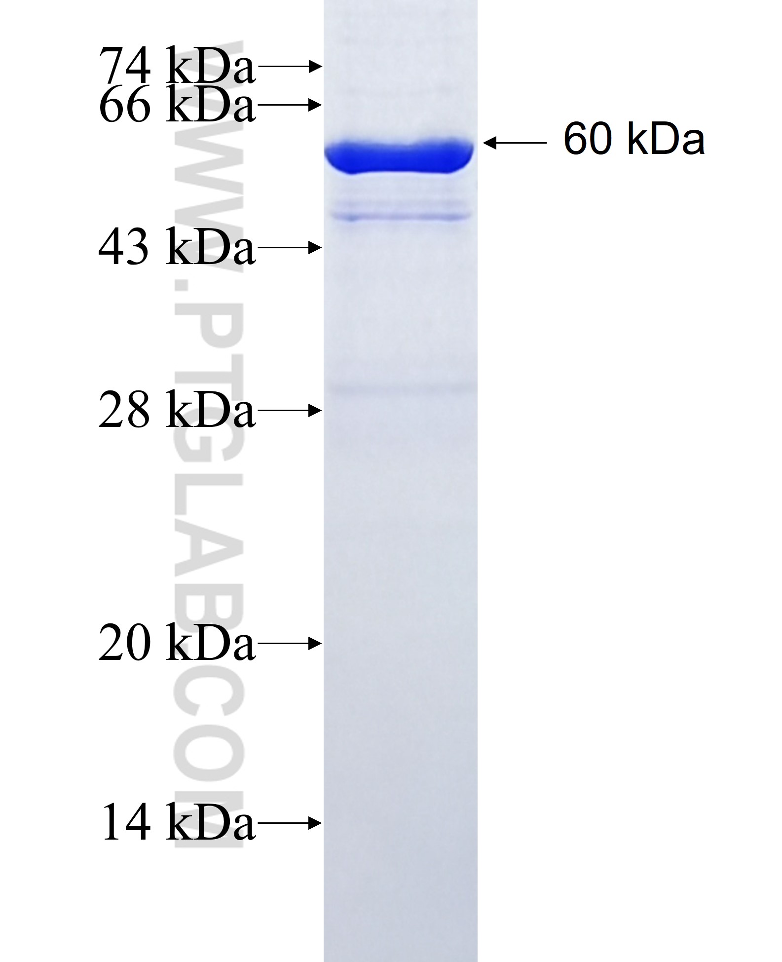 FBXW2 fusion protein Ag2045 SDS-PAGE