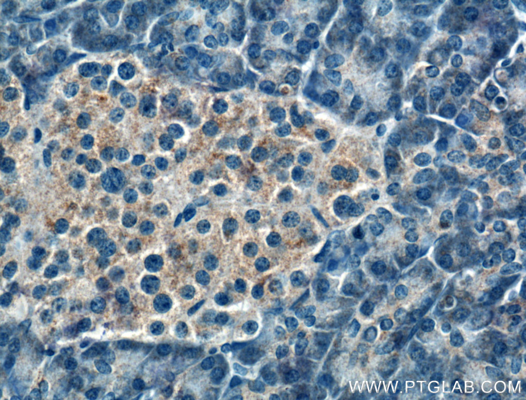 IHC staining of human pancreas using 10657-1-AP (same clone as 10657-1-PBS)