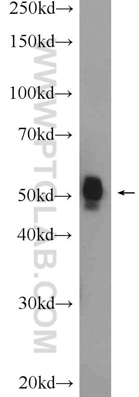 WB analysis of mouse lung using 10657-1-AP