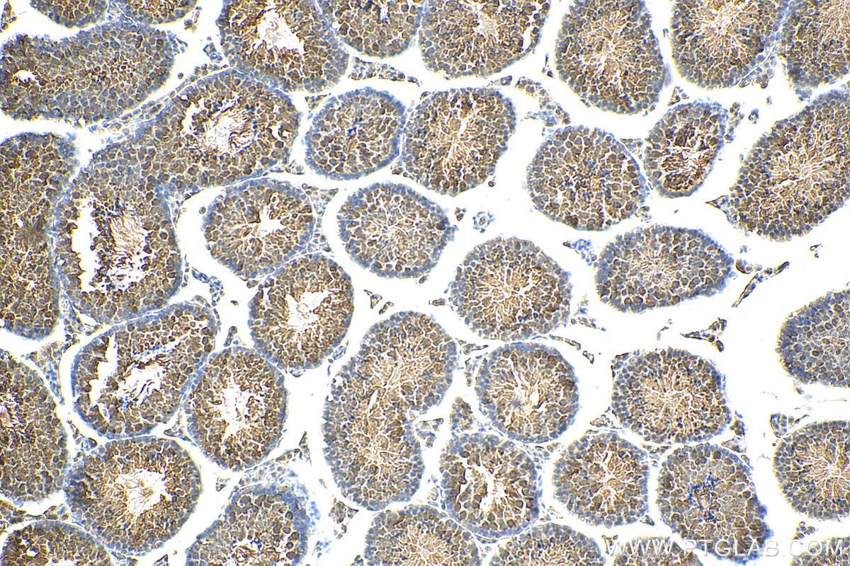 IHC staining of mouse testis using 18321-1-AP (same clone as 18321-1-PBS)