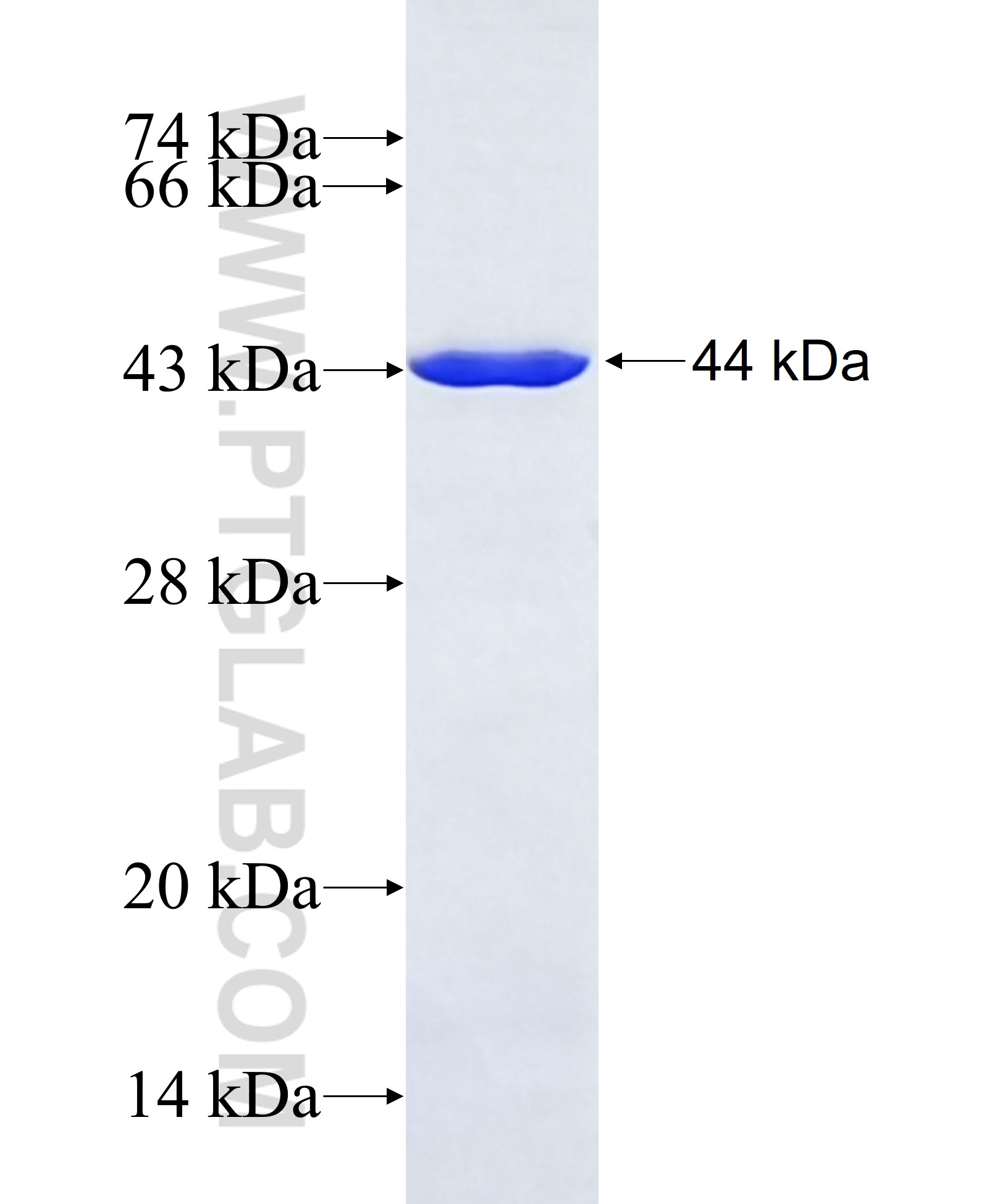 FBXW8 fusion protein Ag40517 SDS-PAGE FBXW8 fusion protein Ag40517 SDS-PAGE