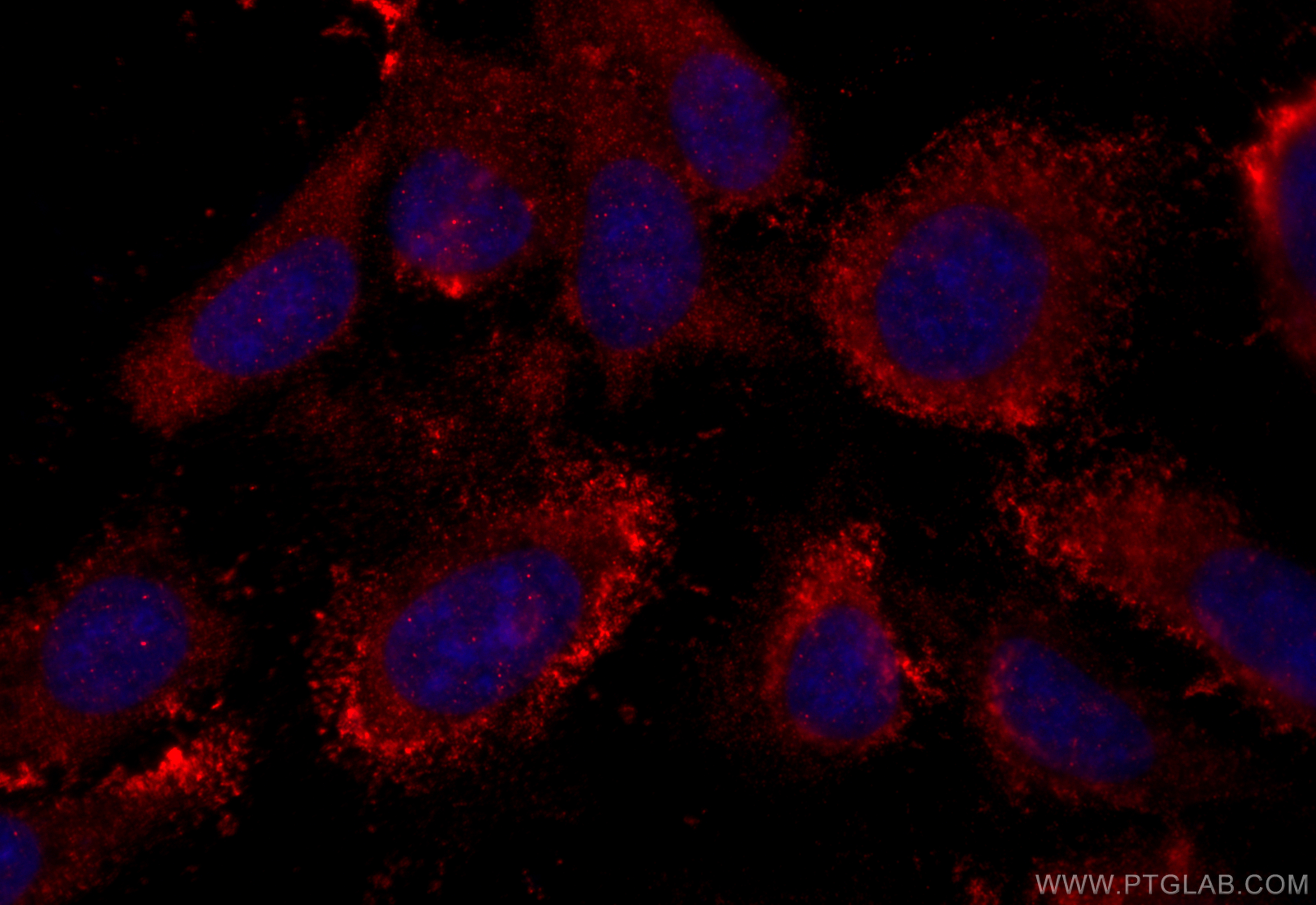 IF Staining of U2OS using 20464-1-AP