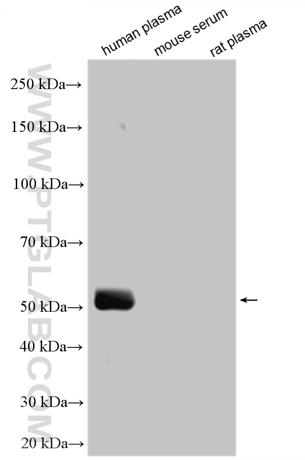 Various lysates were subjected to SDS PAGE followed by western blot with HRP-68275 (FC of Human IgG antibody) at dilution of 1:5000 incubated at room temperature for 1.5 hours. WB analysis using HRP-68275