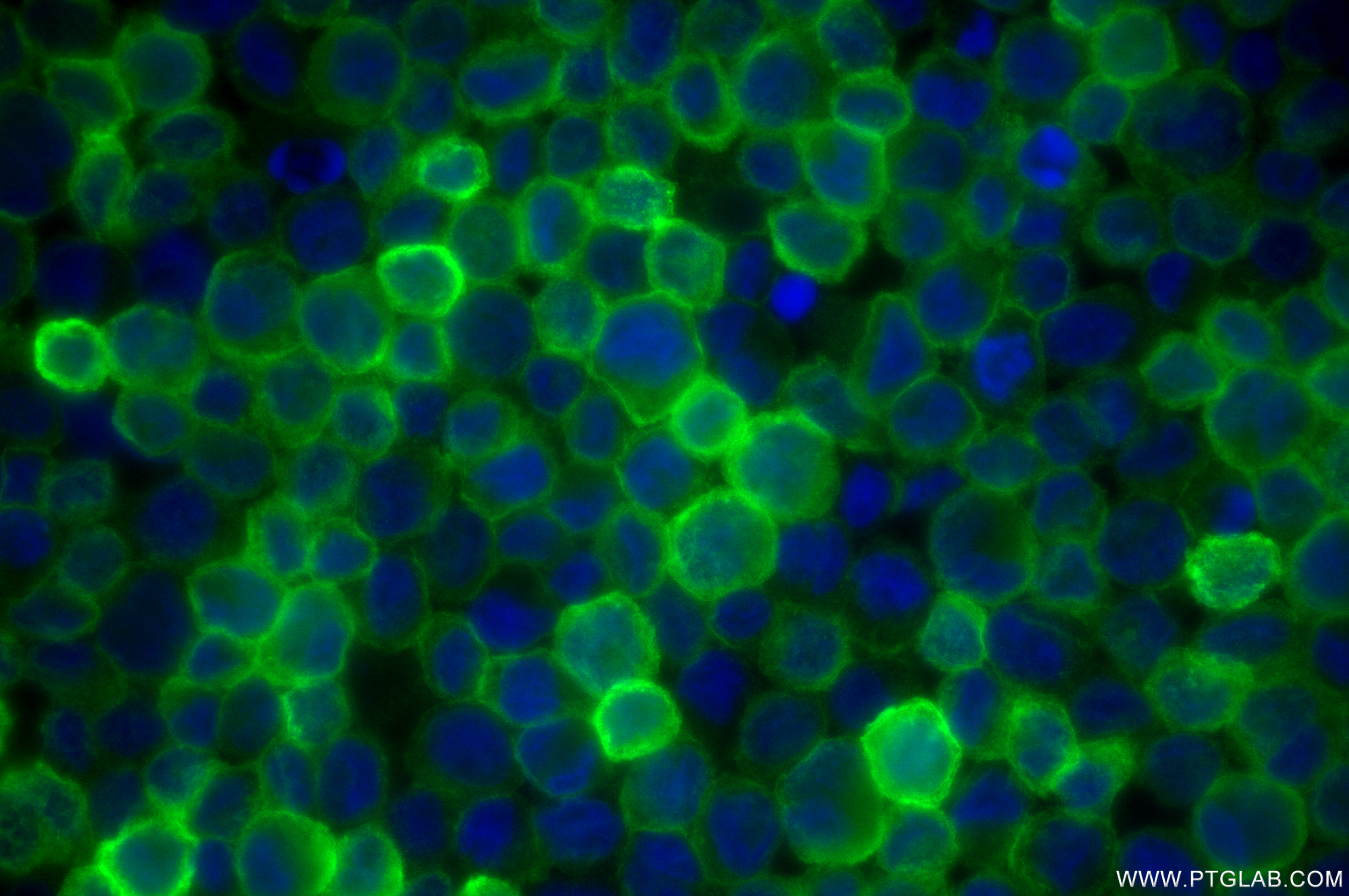 IF Staining of THP-1 using 85390-1-RR