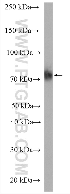 CD64