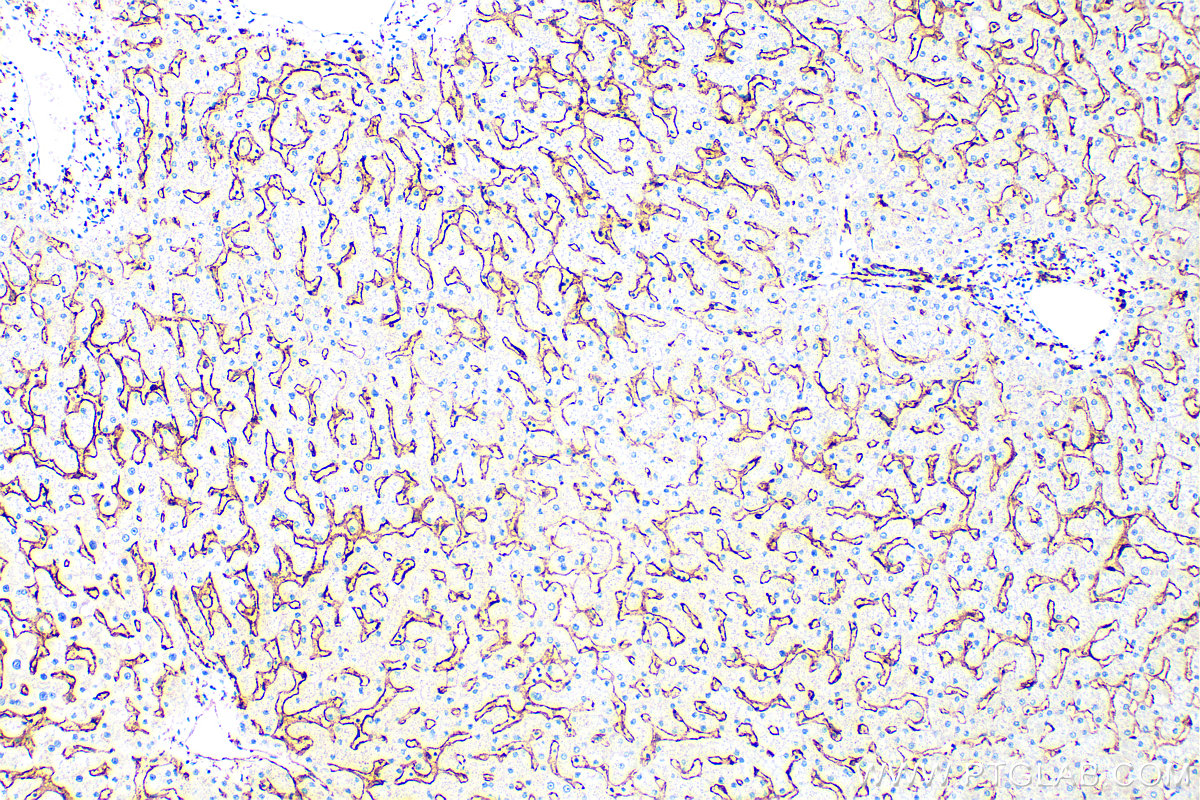 IHC staining of human liver using 15625-1-AP