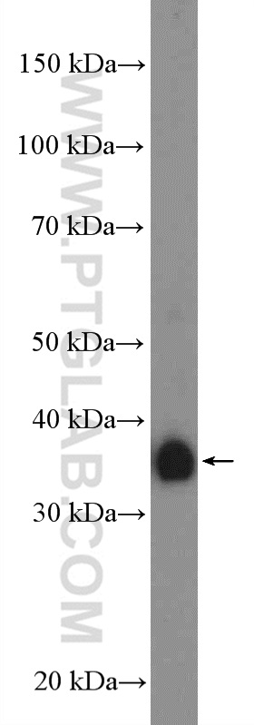 WB analysis of human placenta using 21541-1-AP