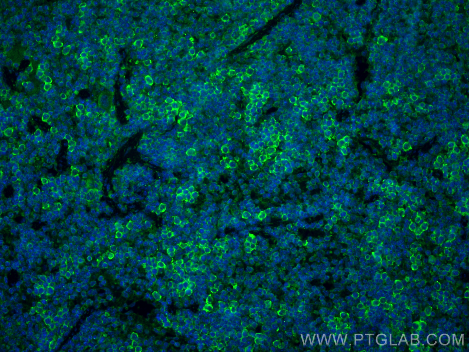 IF Staining of mouse spleen using 30356-1-AP (same clone as 30356-1-PBS)