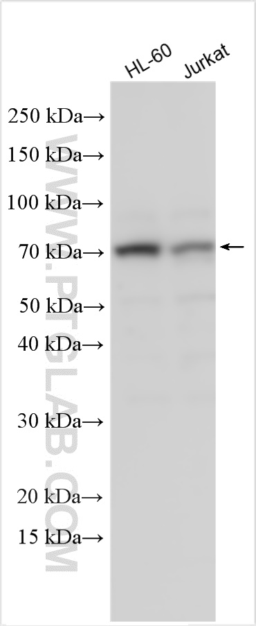 WB analysis using 30356-1-AP