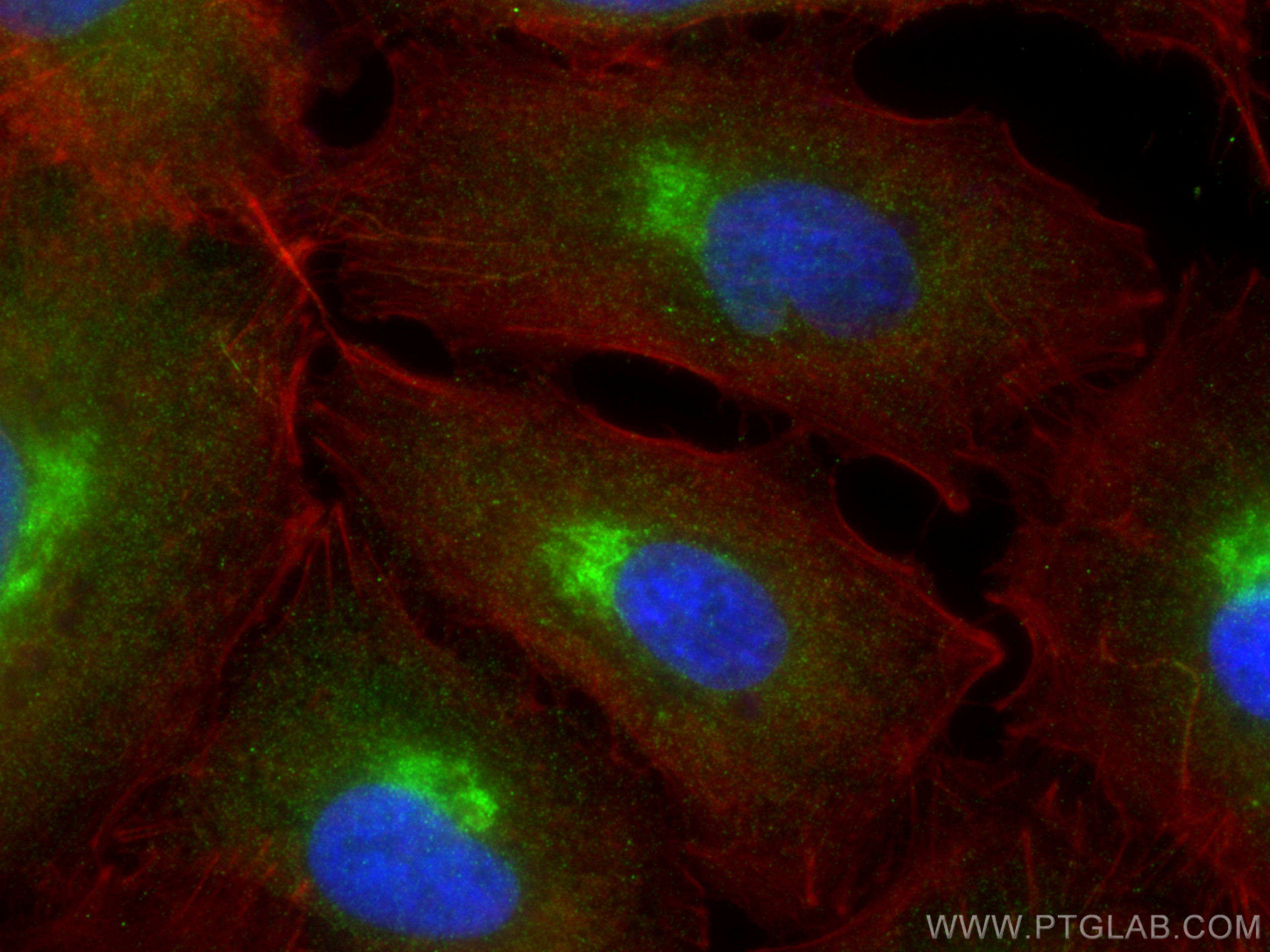 IF Staining of A549 using 30201-1-AP