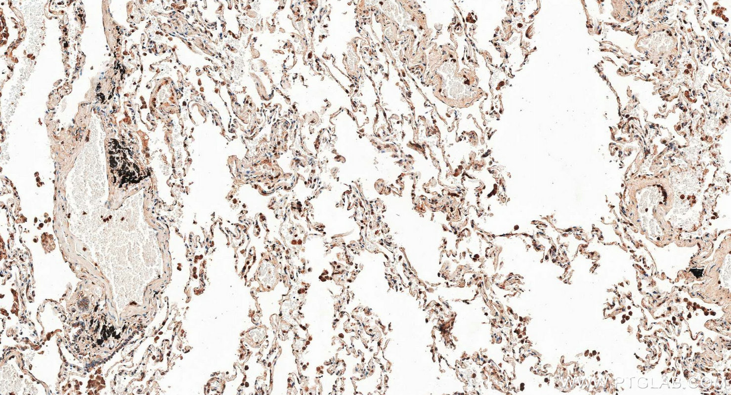 IHC staining of human lung using 30201-1-AP