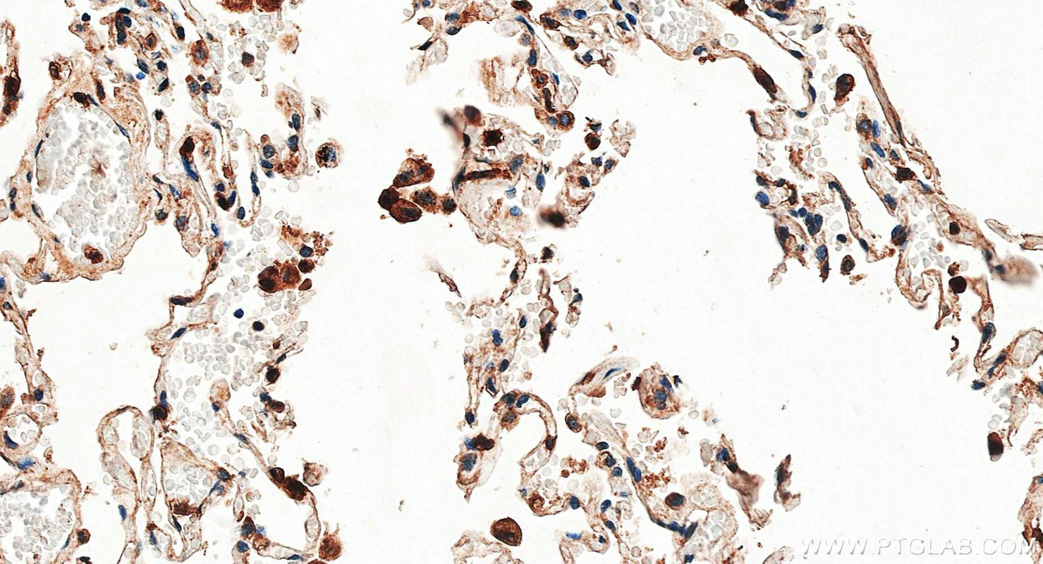 IHC staining of human lung using 30201-1-AP