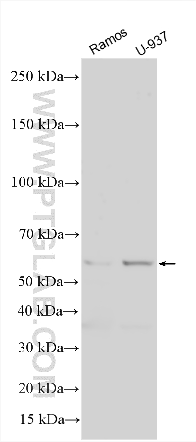 WB analysis using 30201-1-AP WB analysis using 30201-1-AP