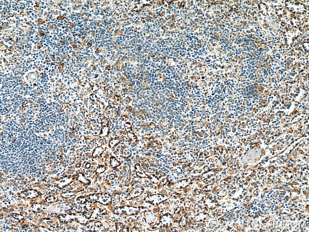 IHC staining of human spleen using 16190-1-AP