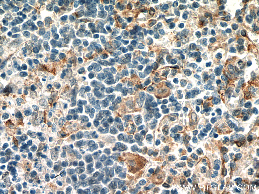 IHC staining of human spleen using 16190-1-AP