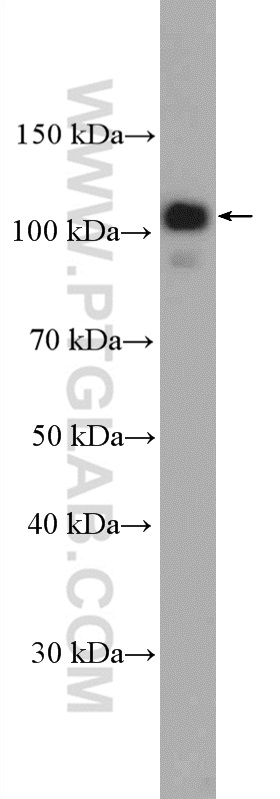 Raji cells were subjected to SDS PAGE followed by western blot with 26767-1-AP (FCHO1 Antibody) at dilution of 1:2000 incubated at room temperature for 1.5 hours. WB analysis of Raji using 26767-1-AP