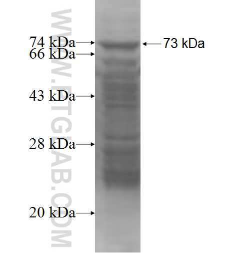 FCRL1 fusion protein Ag4531 SDS-PAGE FCRL1 fusion protein Ag4531 SDS-PAGE