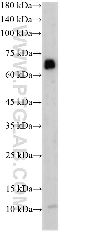 WB analysis of HeLa using 33416-1-AP (same clone as 33416-1-PBS) WB analysis of HeLa using 33416-1-AP (same clone as 33416-1-PBS)