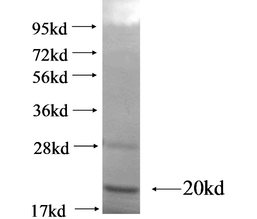 FCRL2 fusion protein Ag19135 SDS-PAGE FCRL2 fusion protein Ag19135 SDS-PAGE