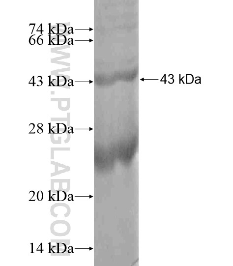 FCRL2 fusion protein Ag19200 SDS-PAGE FCRL2 fusion protein Ag19200 SDS-PAGE