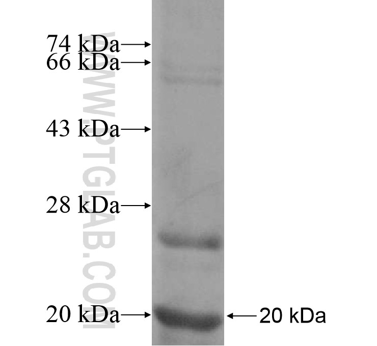 FCRL5 fusion protein Ag15716 SDS-PAGE FCRL5 fusion protein Ag15716 SDS-PAGE