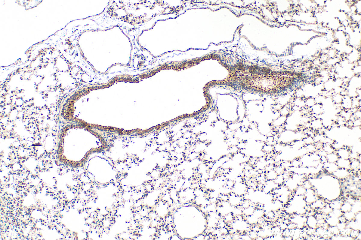 IHC staining of mouse lung using 17157-1-AP