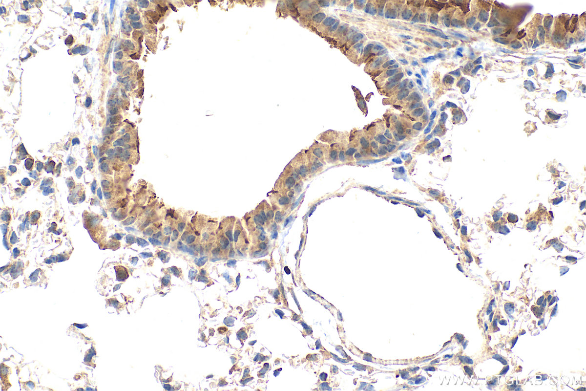 IHC staining of mouse lung using 17157-1-AP
