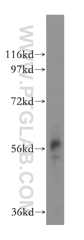 WB analysis of mouse lung using 17157-1-AP