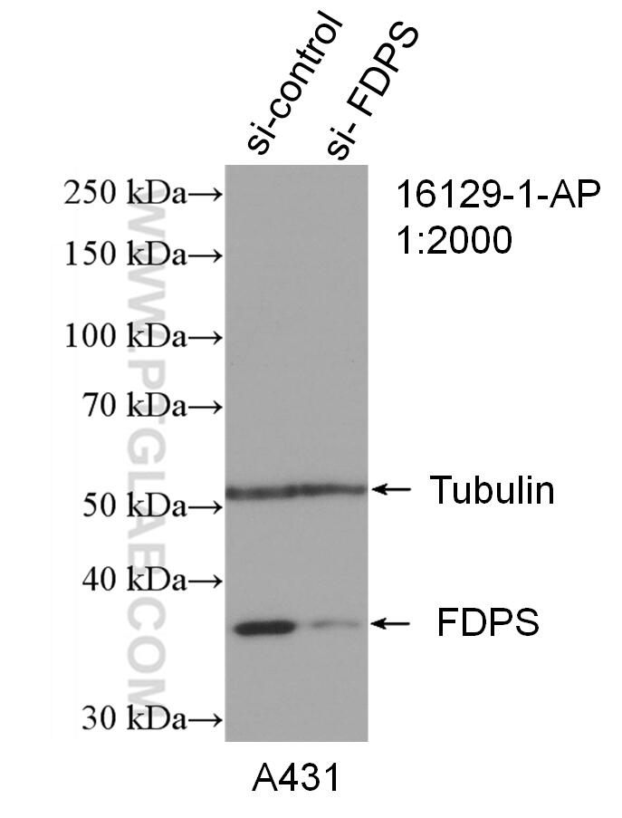 WB analysis of A431 using 16129-1-AP