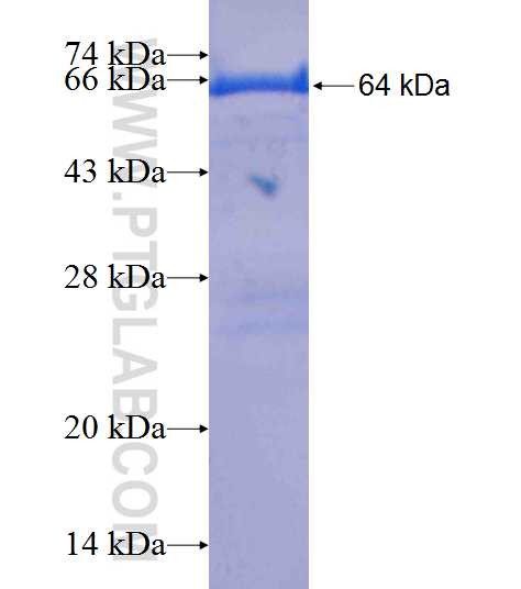 FDPS fusion protein Ag9115 SDS-PAGE