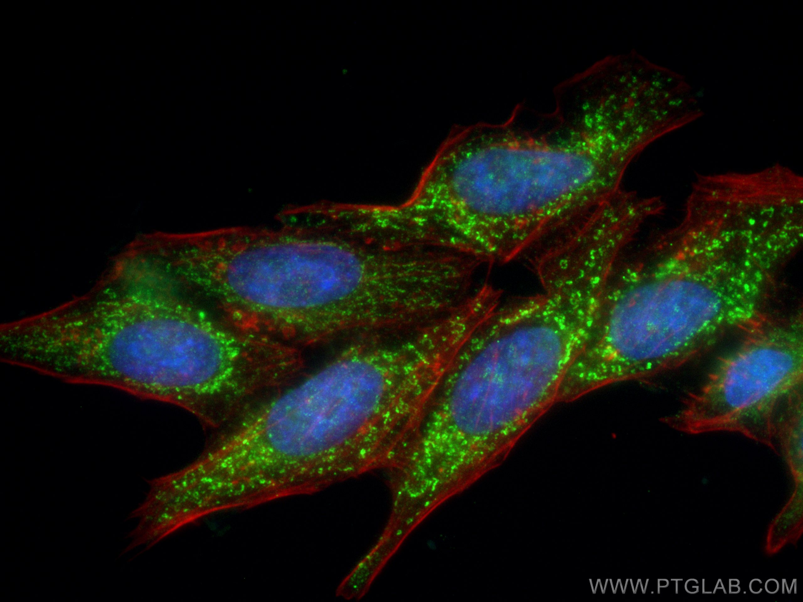 IF Staining of HepG2 using 12592-1-AP