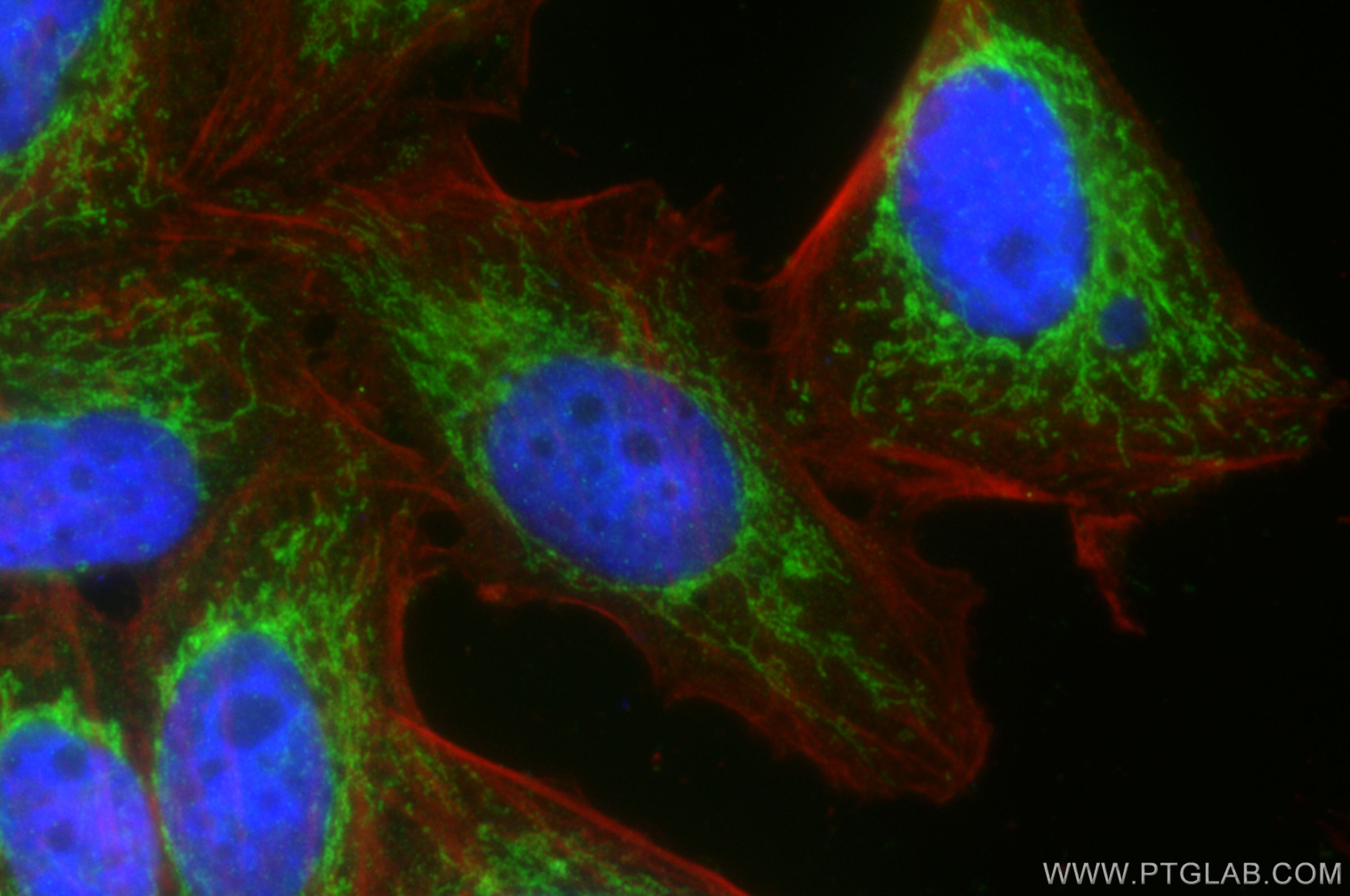 IF Staining of HepG2 using 12592-1-AP