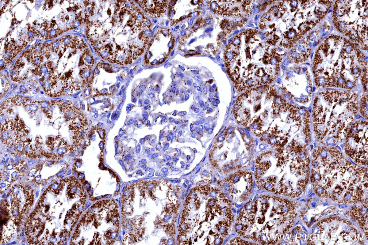 IHC staining of human kidney using 12592-1-AP IHC staining of human kidney using 12592-1-AP