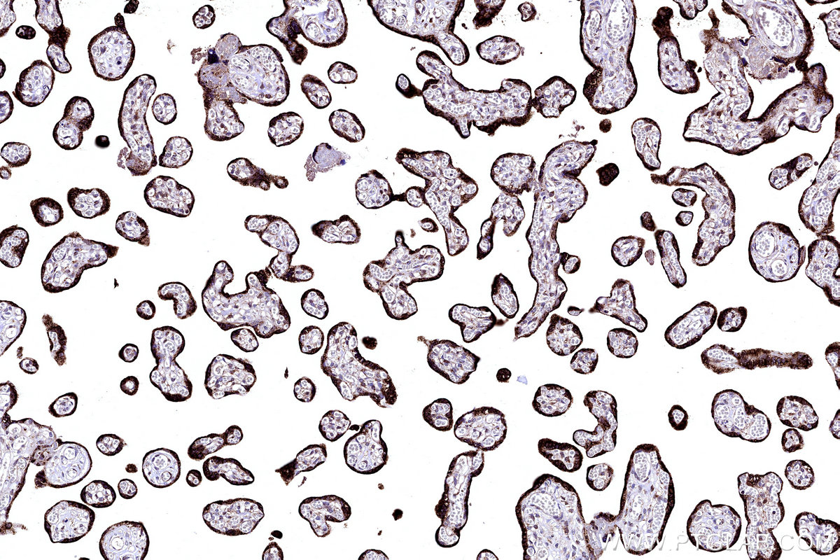 IHC staining of human placenta using 12592-1-AP IHC staining of human placenta using 12592-1-AP