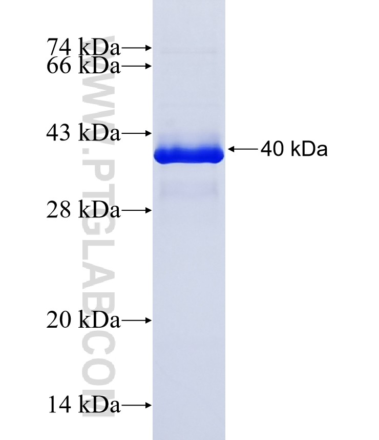 FDX1 fusion protein Ag41687 SDS-PAGE FDX1 fusion protein Ag41687 SDS-PAGE