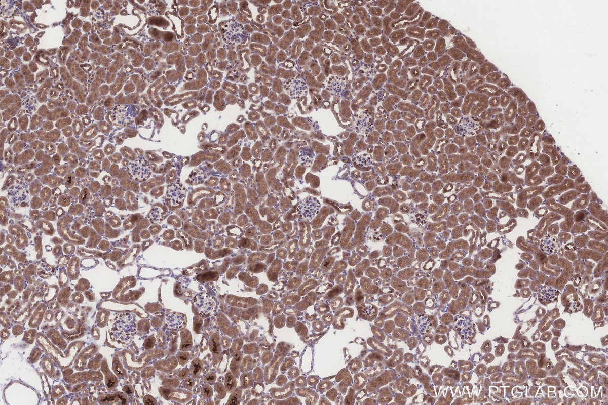 IHC staining of mouse kidney using 32790-1-AP