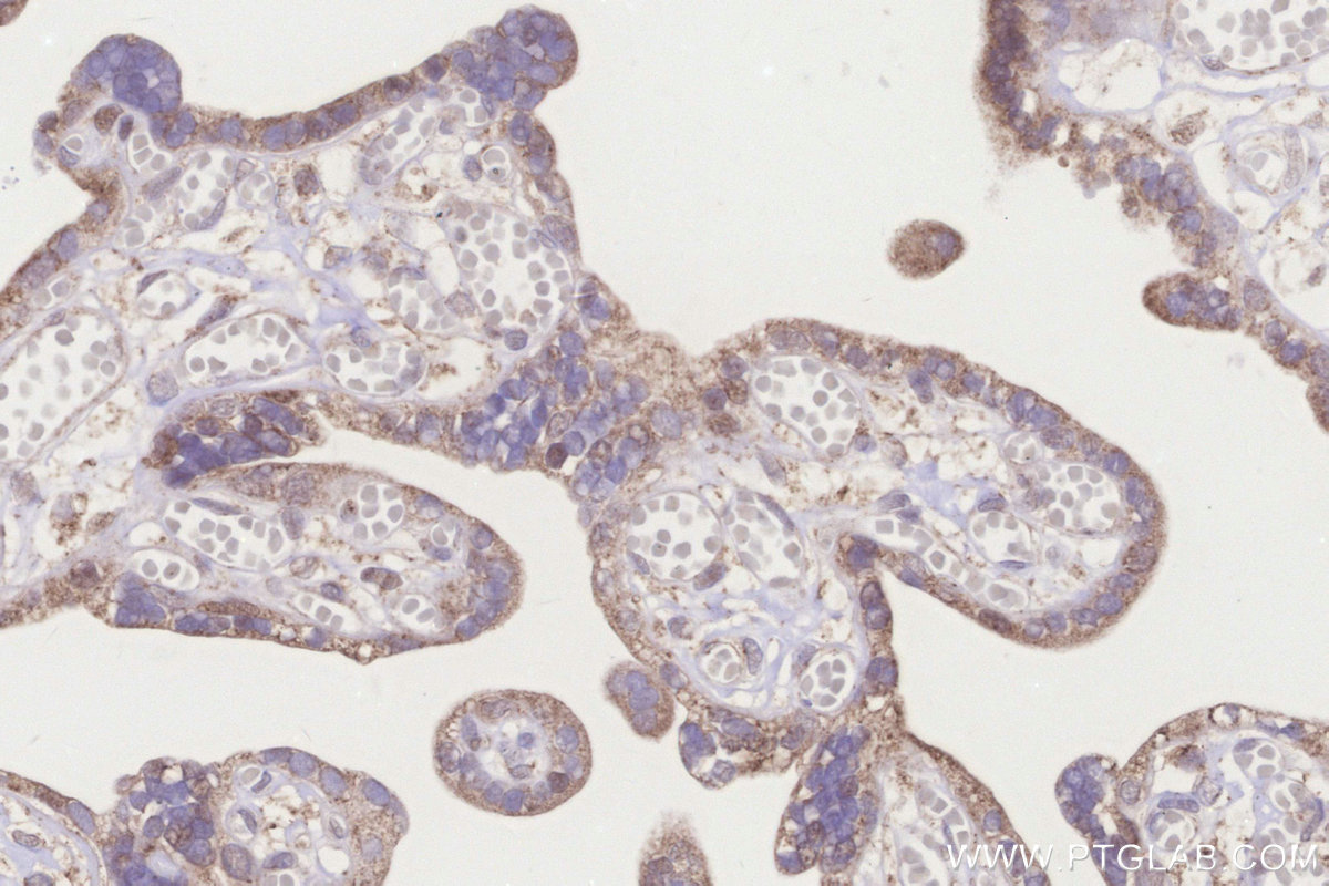 IHC staining of human placenta using 32790-1-AP