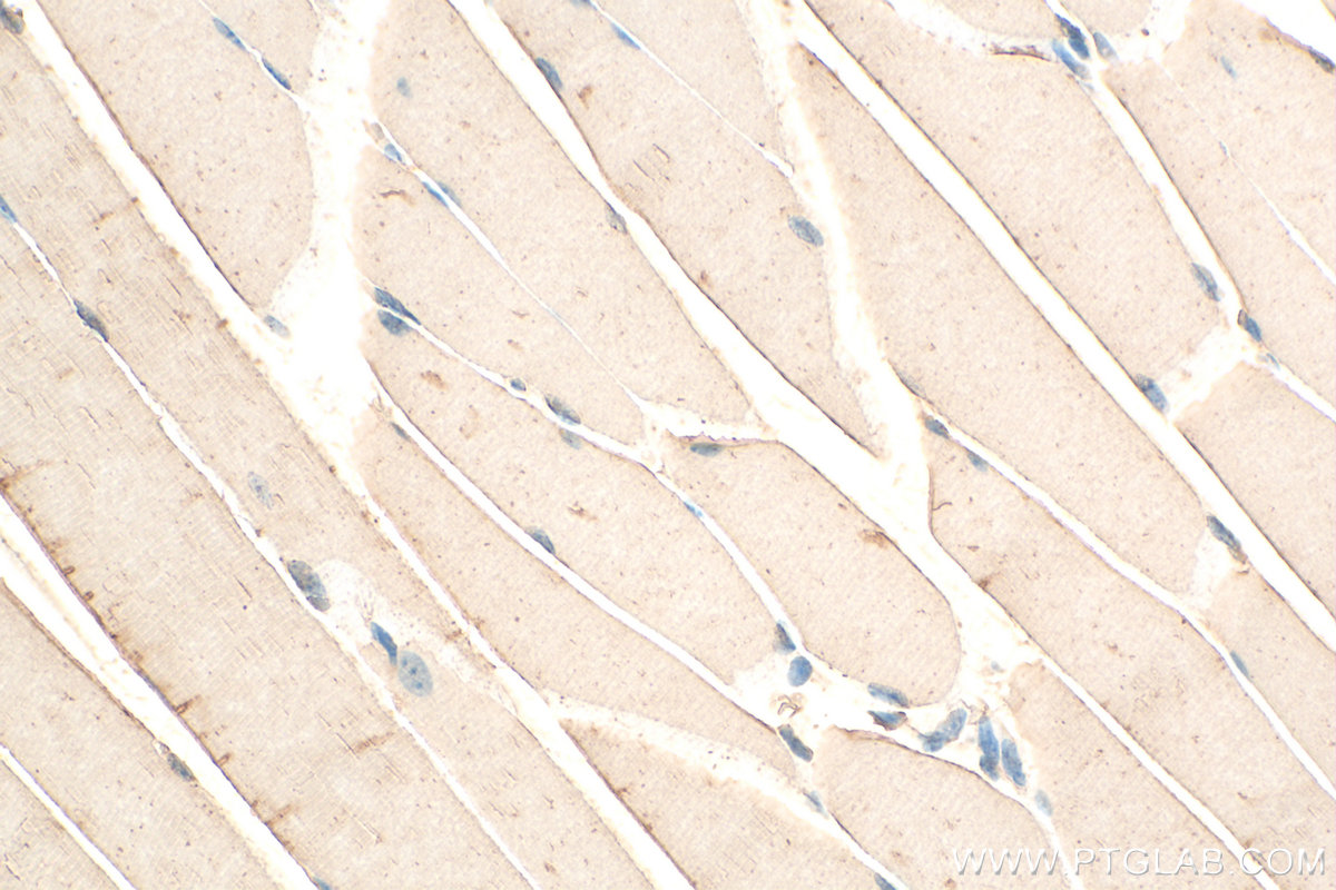 IHC staining of mouse skeletal muscle using 15169-1-AP
