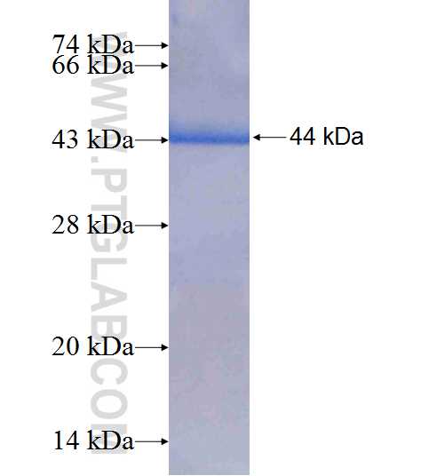 FEM1A fusion protein Ag7524 SDS-PAGE FEM1A fusion protein Ag7524 SDS-PAGE