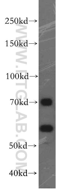 WB analysis of PC-3 using 19544-1-AP