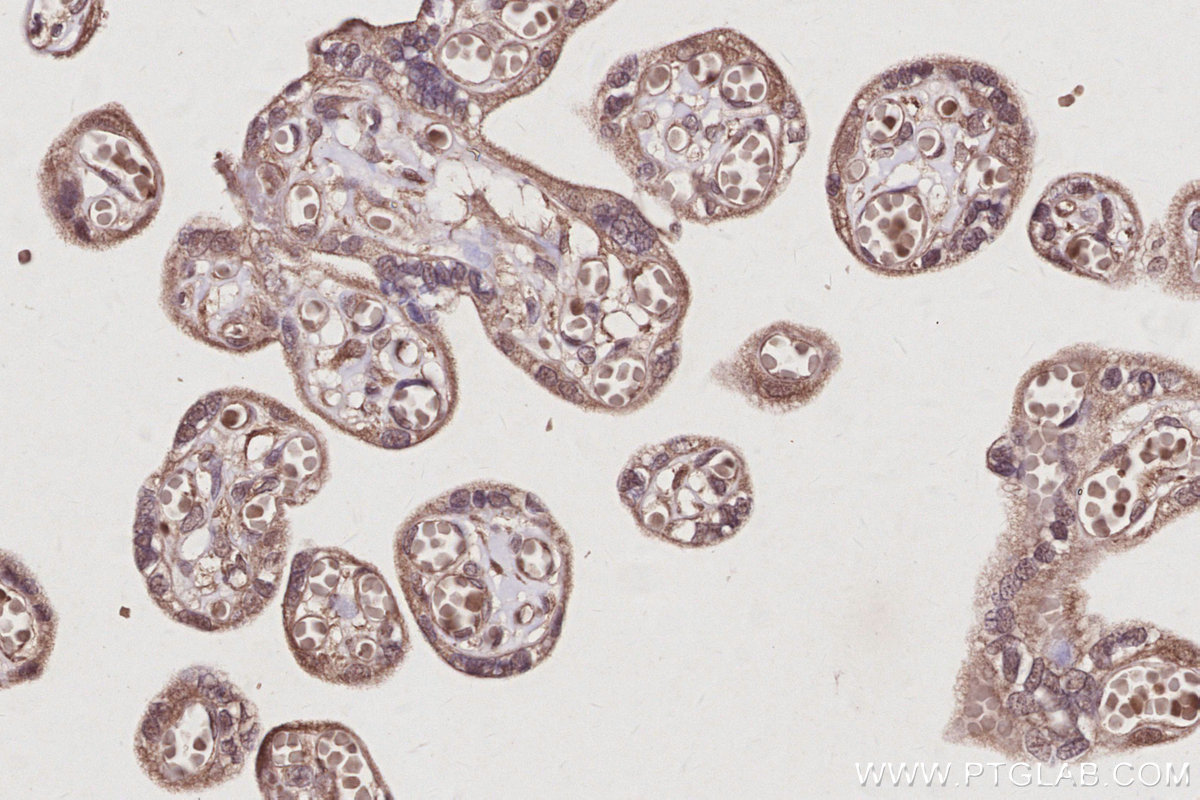 IHC staining of human placenta using 83810-1-RR IHC staining of human placenta using 83810-1-RR