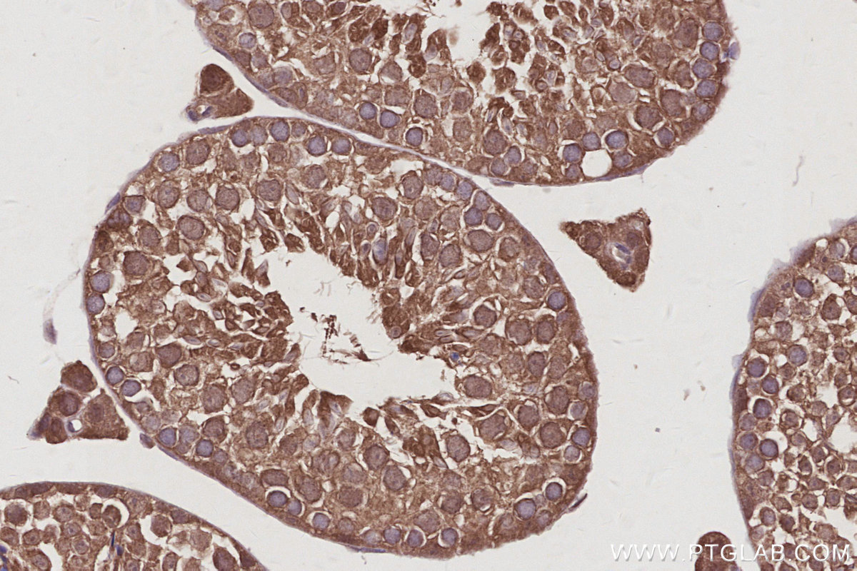 IHC staining of mouse testis using 83810-1-RR IHC staining of mouse testis using 83810-1-RR