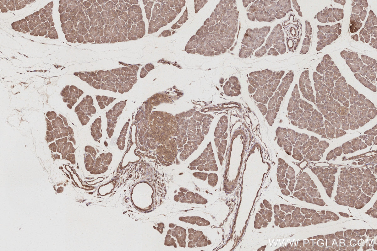 IHC staining of rat pancreas using 83810-1-RR IHC staining of rat pancreas using 83810-1-RR