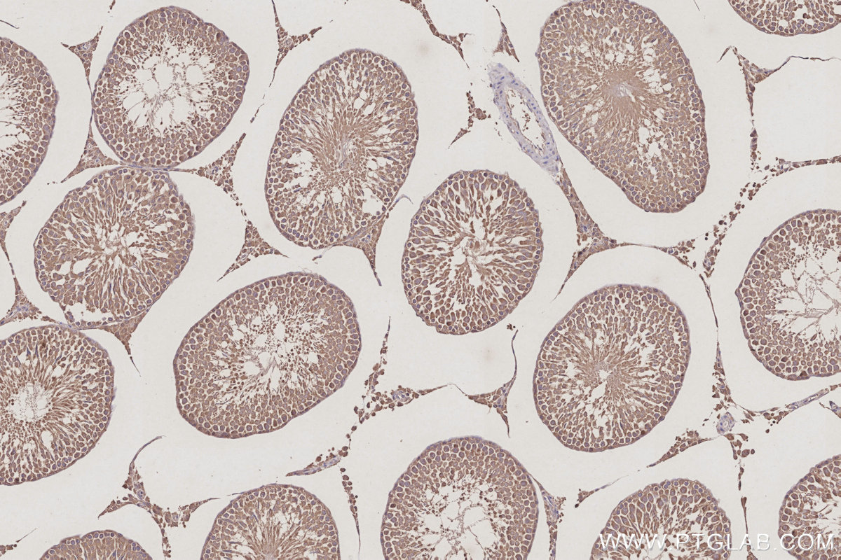 IHC staining of rat testis using 83810-1-RR IHC staining of rat testis using 83810-1-RR