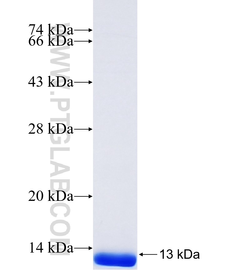 FEM1B fusion protein Ag41444 SDS-PAGE FEM1B fusion protein Ag41444 SDS-PAGE